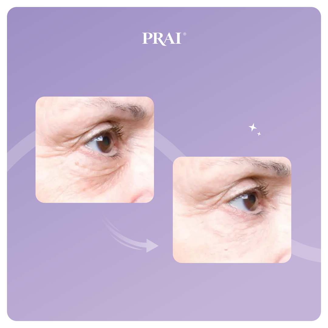 Ageless Eye Tight Uplift Serum